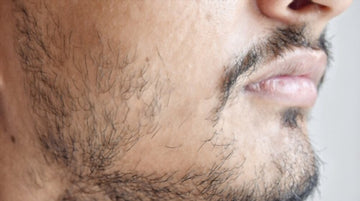 How to Fix a Patchy Beard â€“ Reasons & Solution
