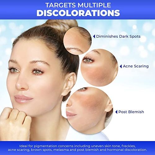 Fair & White Original Anti Dark Spot Remover Spray